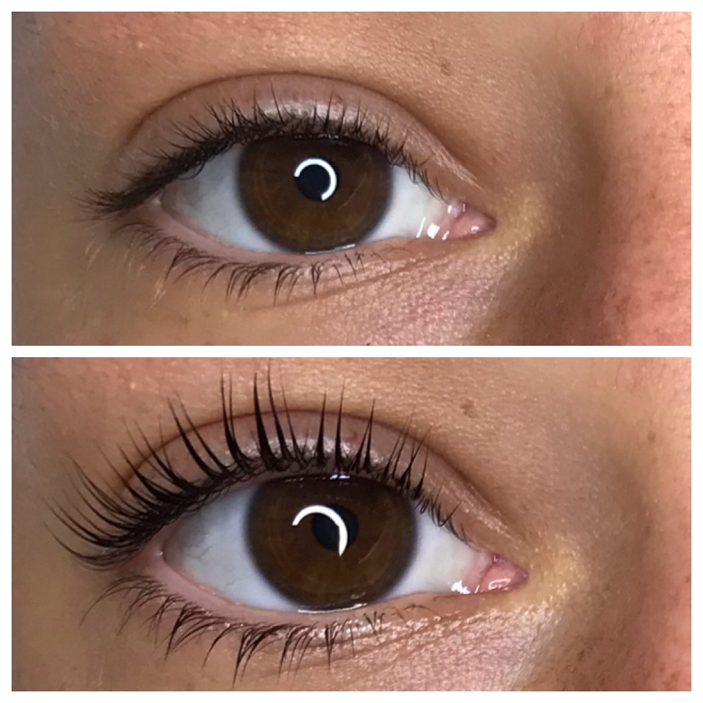 eyelash lift